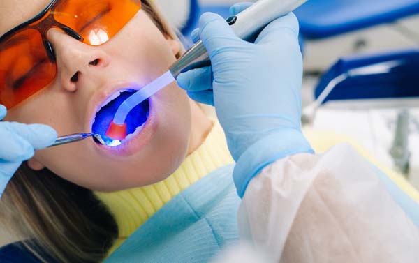 Dental Bonding And Teeth Whitening